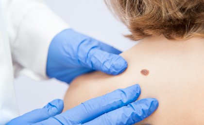 Stock image of a doctor examining a patient's skin 